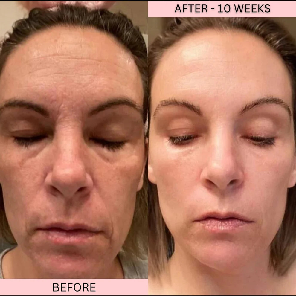 LowkClear Rejuvenate - 4 Color LED Mask