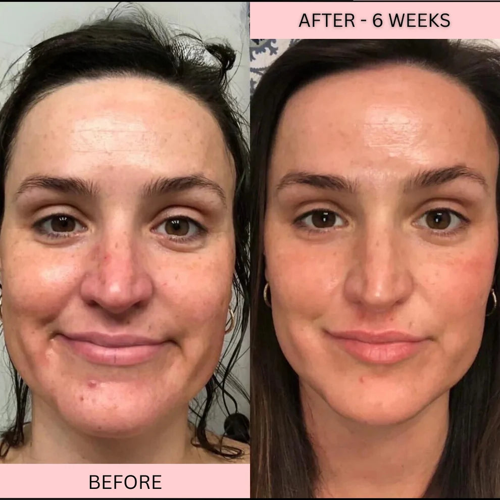 LowkClear Rejuvenate - 4 Color LED Mask