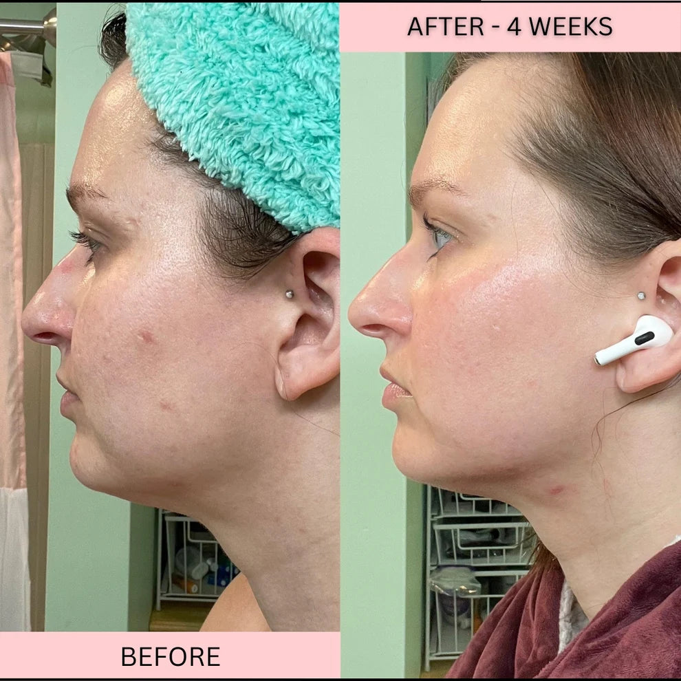 LowkClear Rejuvenate - 4 Color LED Mask